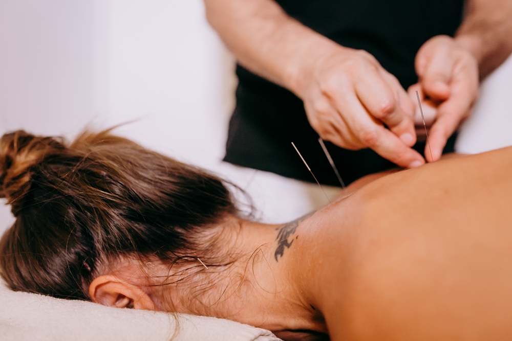 Read more about the article Acupuncture as Part of a Self Care Routine